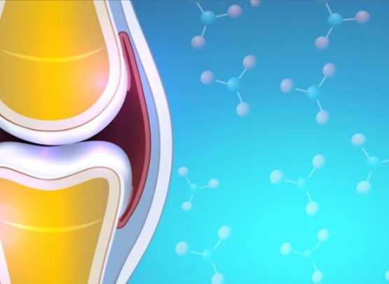 artrose infiltração 