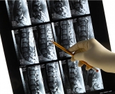 dor lombar ressonância 