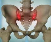 imunobiológicos e espondilite anquilosante