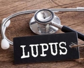 lúpus dicas