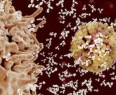 lúpus e autoanticorpos