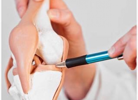 menisco artrose cirurgia