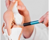 menisco artrose cirurgia