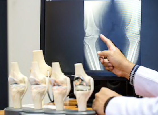 tipos de artrose do joelho 